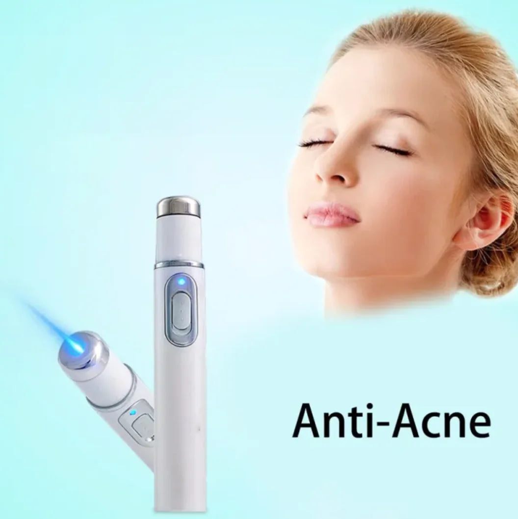 Blue Light Acne Remover Pen – Clear Skin Therapy